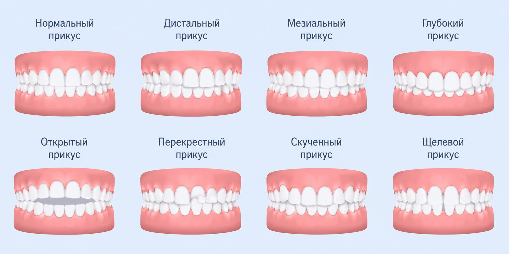 Виды нарушений прикуса у детей