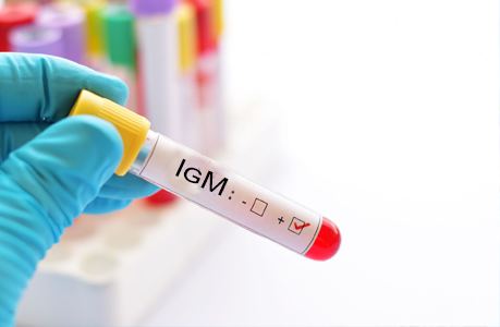 Антитела к коронавирусу IgM